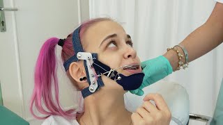 Pink Hair Headgear Girl gets Permanent Orthodontic Headgear 🤐