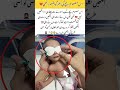 When Baby Opened His Eyes ❤️👶✨#MotherLove#BabyLove#viralshort#baby#trending#foryou#viralshort#fypシ゚