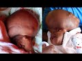 Doctors Told Me That My Baby Will Never Make It : THIS VIDEO WILL MAKE YOU CRY