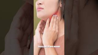 Strep Throat Home Remedies Strep Throat Home Remedies