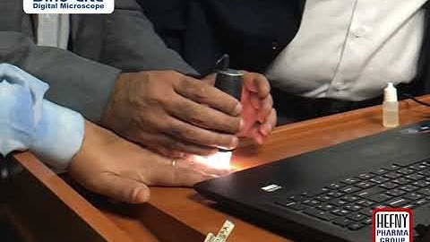 Dino-Lite - Capillaryscopic Application in Rheumatology Field at Al Hussein University Hospital