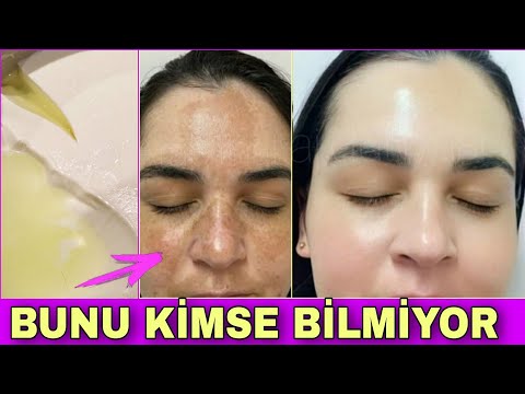 Etkisine Şaşıracaksınız! Güneş Lekesi, Çil, Kahverengi Lekeler, Tüm CİLT LEKELERİNİ GİDEREN FORMÜL