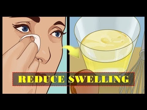 How to Reduce Swelling in Face Naturally After Sleep in the Morning Home Remedies
