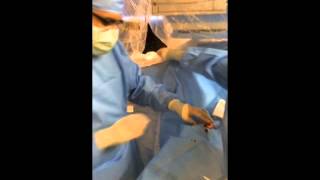 Accessing The Radial Artery