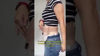 Bumps,Leakage—ostomy fears?😣Heagi Stoma Shield has your back—literally.#ostomy #ostomate #ostomybag