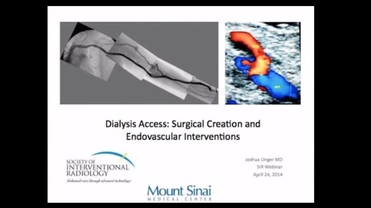SIR-RFS Webinar (4/24/14): Dialysis Access Surgical Creation and ...