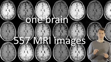one brain - 557 MRI images