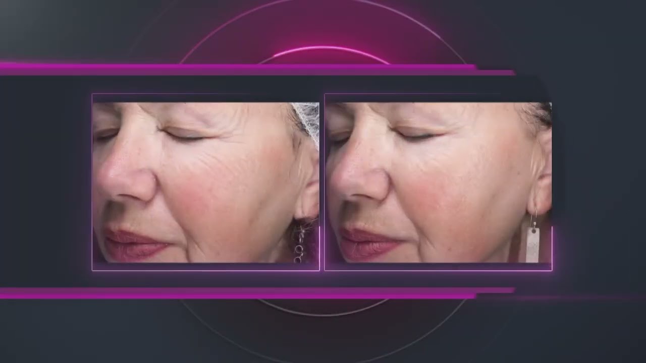 Matrix RF Platform - how it works