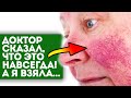 Купероз как ветром сдуло! 4 ст.л. уксуса + 2 ст.л. мёда + 2 ст.л...