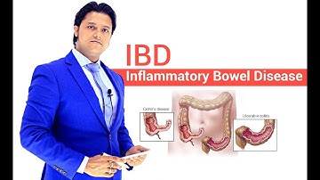 MRCP Part-1 | IBD (Inflammatory Bowel Disease) - Key Differences