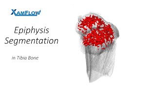 Epiphysis Segmentation in Tibia Bone