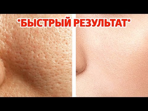 Как ИЗБАВИТЬСЯ от БОЛЬШИХ ПОР и Получить ГЛАДКУЮ КОЖУ