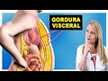 Como Perder Gordura Visceral Rápido - DIMINUA A BARRIGA!