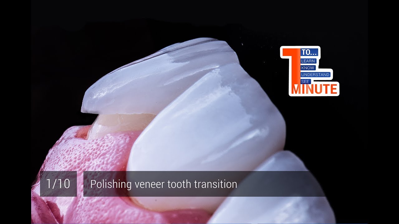 Polishing veneer tooth transition.