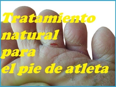 matar los hongos de los pies