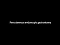 Percutaneous endoscopic gastrostomy (PEG), paediatric case.