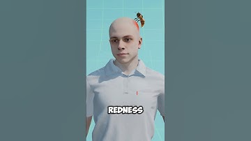 Why YELLOW Wasp Sting Hurt So Bad? 😨