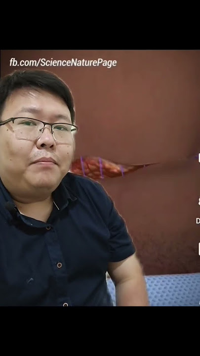 Seperti ini jika melahirkan secara sesar