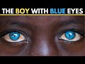 The AFRICAN Boy With The BLUE Eyes