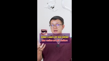 Răng lung lay khi niềng, là hiện tượng bình thường hay bất thường?