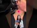 Plastic surgeon’s take on non-invasive facelifts