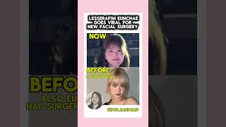 Famous #lesserafim #eunchae goes viral for getting more surgery on her face #kpopnews #kpop #plasticsurgery Net Worth