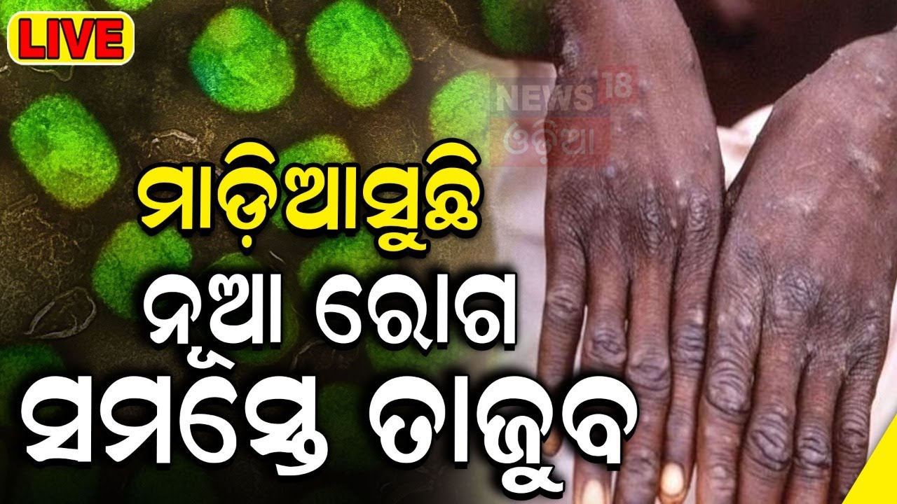 Live: ବଢ଼ିଲା ଚିନ୍ତା | Airports On High Alert As Pakistan Intensifies Steps Against Monkeypox