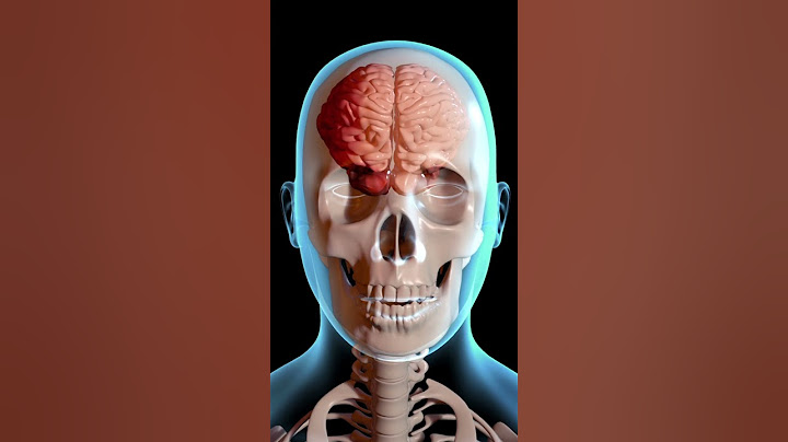 CONMOCION #cerebral -¿Qué le pasa a nuestro cebrero?
