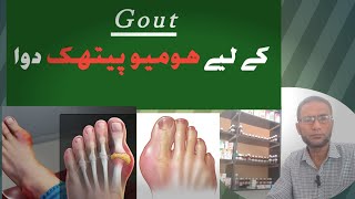 gout diet  gout homeopathy medicine   uric acid kam karne ke upay, kaise hota hai and dava