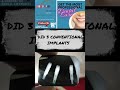 Step-by-Step Placement of Molar Conventional Dental Implants WITH OPG