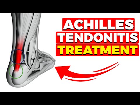 Back of the Heel Achilles Tendinosis Pain [Exercises & Pain Relief]