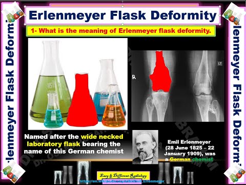      تعرف على اسبابه بطريقة مبسطة