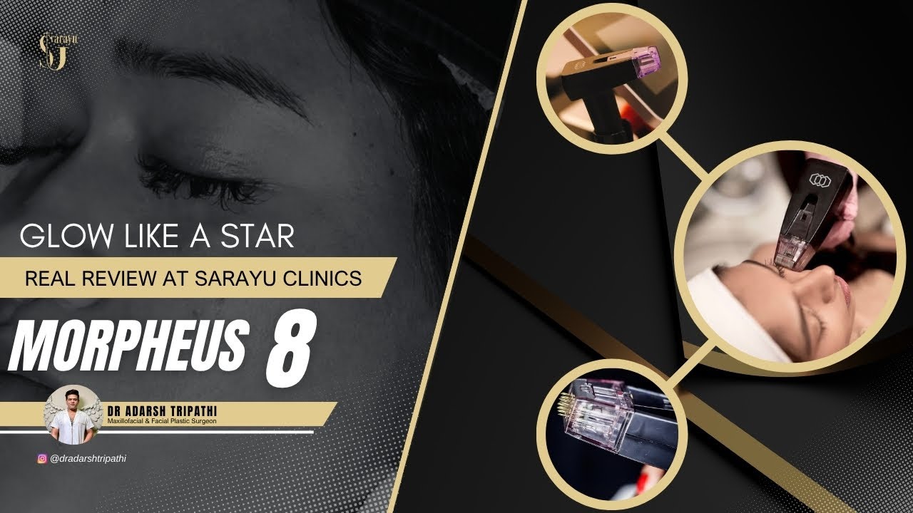 Morpheus8 Treatment | Advanced Skin Tightening by Dr Adarsh Tripathi - Sarayu Clinics