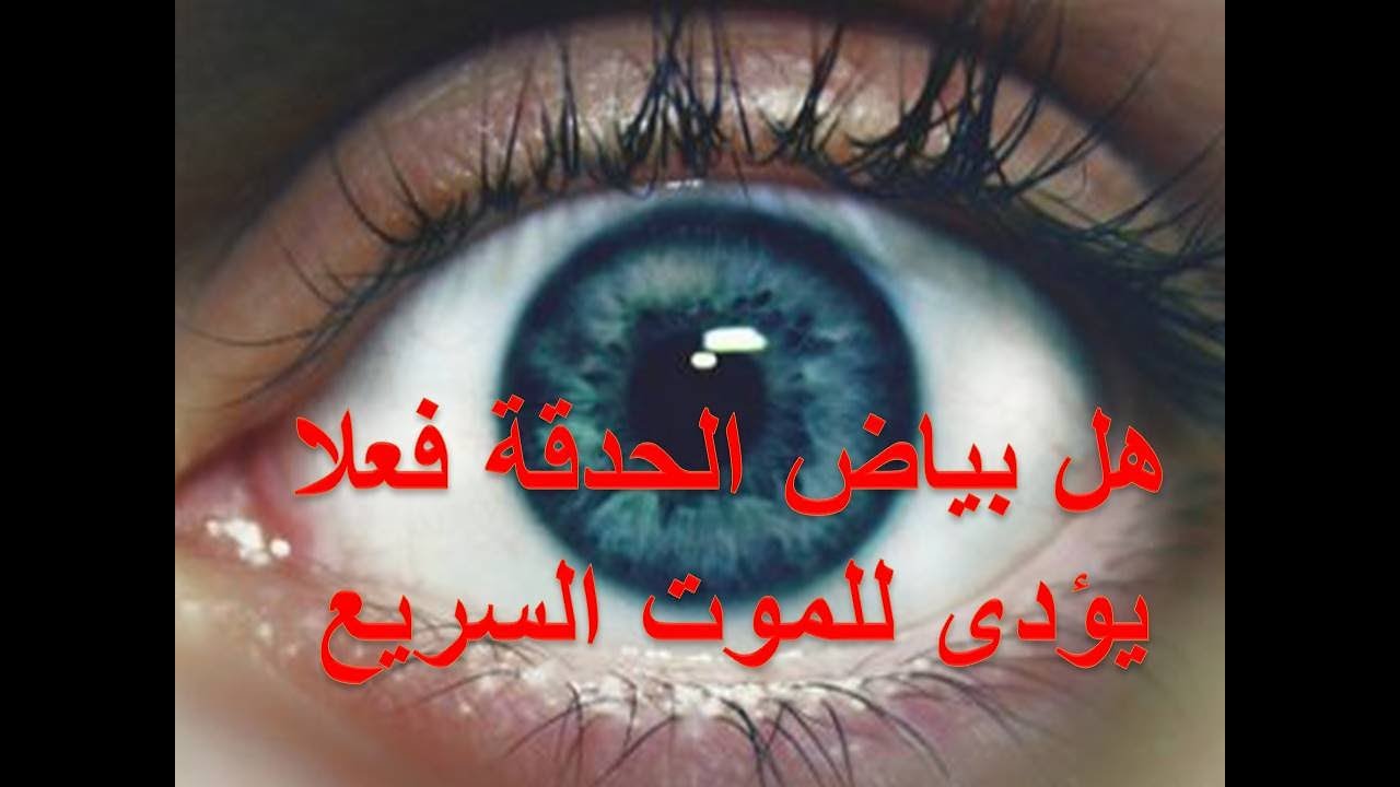هل فعلا بياض العين يؤدى إلى الموت السريع والفورى ؟ / إصنع حلمك / تفاصيل خطيرة (12) .