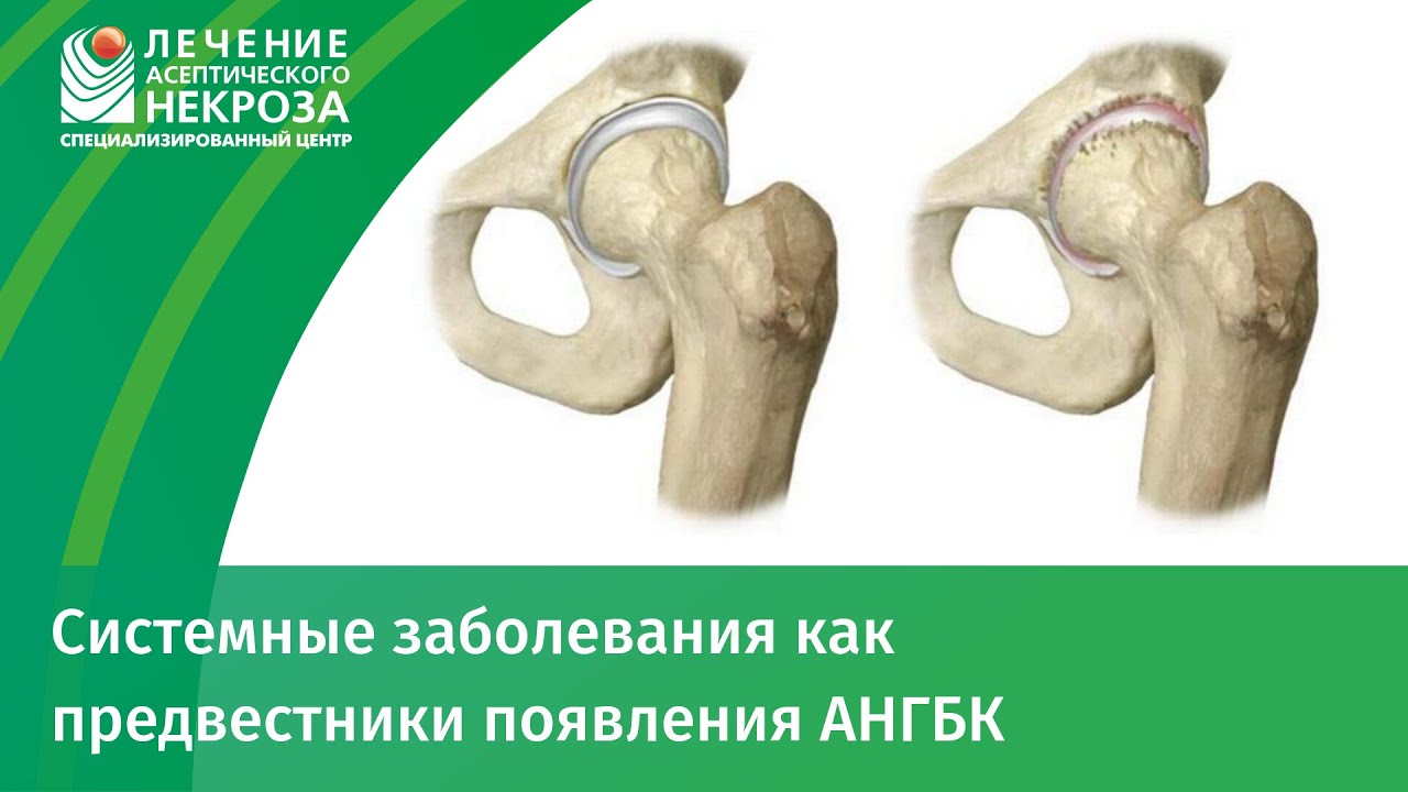 Системные заболевания как предвестники появления АНГБК