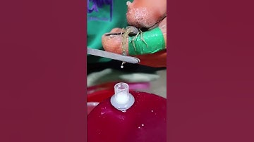 Gấu Trúc Reaction | Lấy Nọc Độc Bọ Cạp #animal