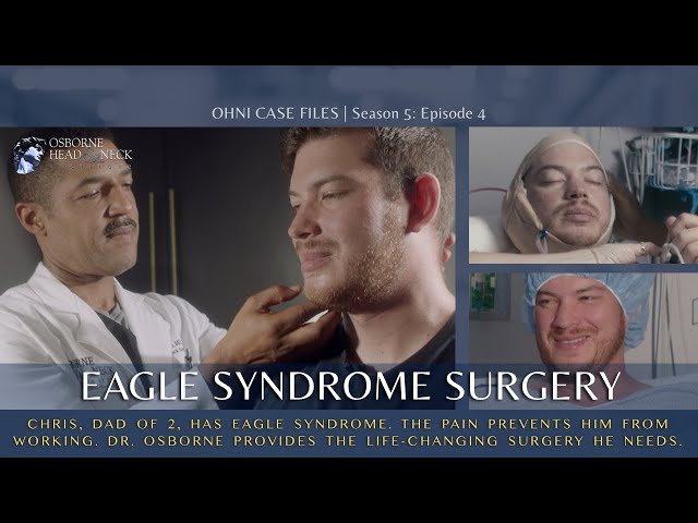 Eagle Syndrome Surgery: Life-Changing Experience for a Blue Collar Worker | Dr. Ryan Osborne