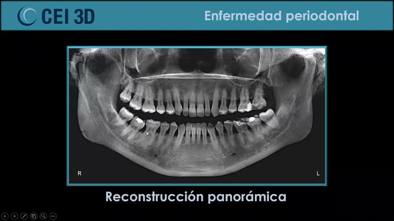 Webinar Tomografía Cone Beam y sus aplicaciones en Odontología
