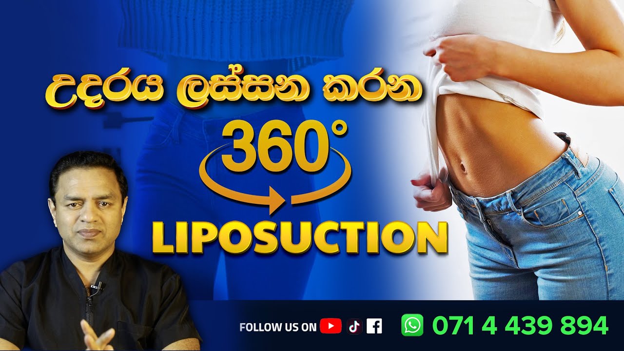 උදරය හැඩකරන 360 Liposuction Plastic surgery Kandy Sri Lanka ලයිපොසක්ෂන්