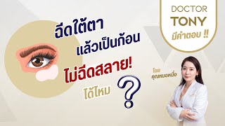 ฉีดใต้ตาแล้วเป็นก้อน ไม่ฉีดสลายได้ไหม? #DoctorTonyClinic