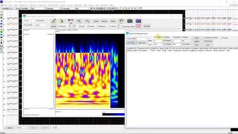 MEG/EEG Time Frequency Analysis 04