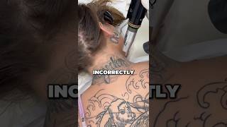 The Hidden Danger Of Tattoo Removal 😮 The Hidden Danger Of Tattoo Removal 😮