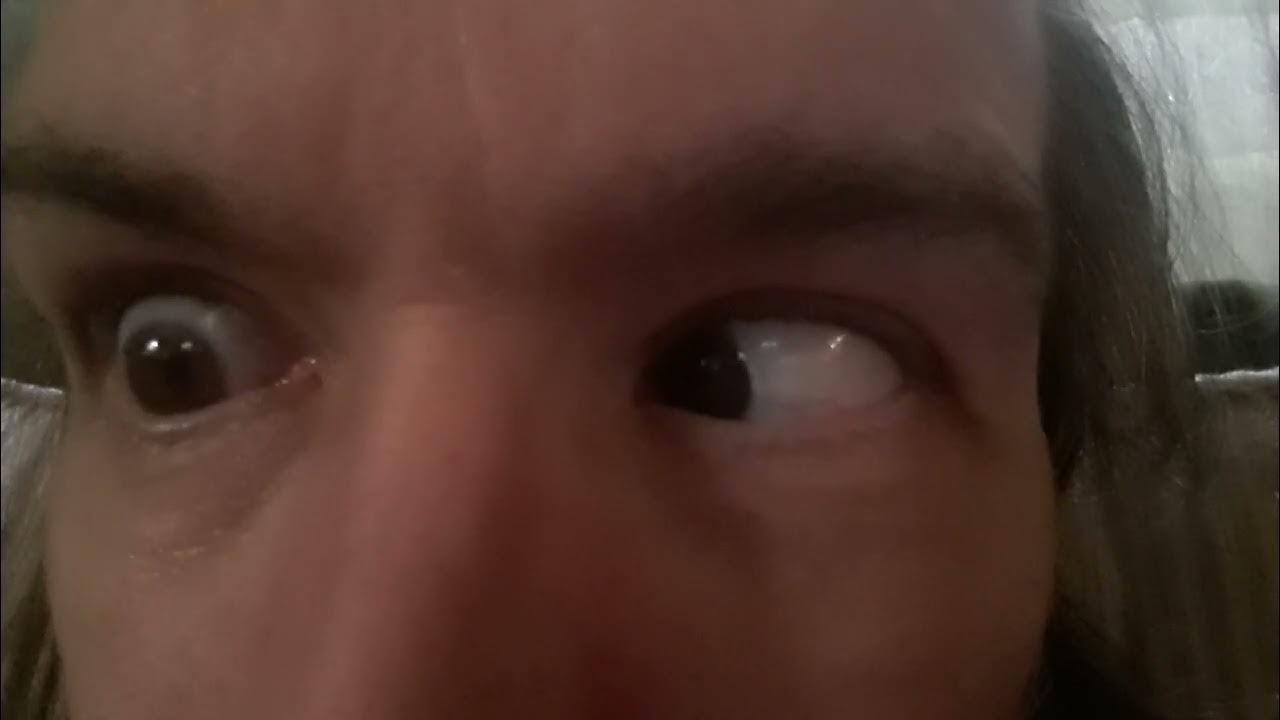 Independent Eye Movement - YouTube