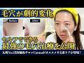 【毛穴消滅】浸透率1000%超え!? ダーマローラーの劇的効果と失敗しないセルフケア術