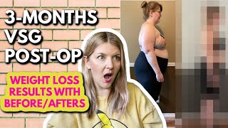 VSG 3 Months Post Op Update | Bariatric Weight Loss Journey | A HUGE Achievement Unlocked