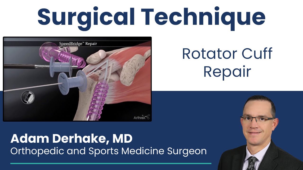 Rotator Cuff Repair: Surgical Technique 