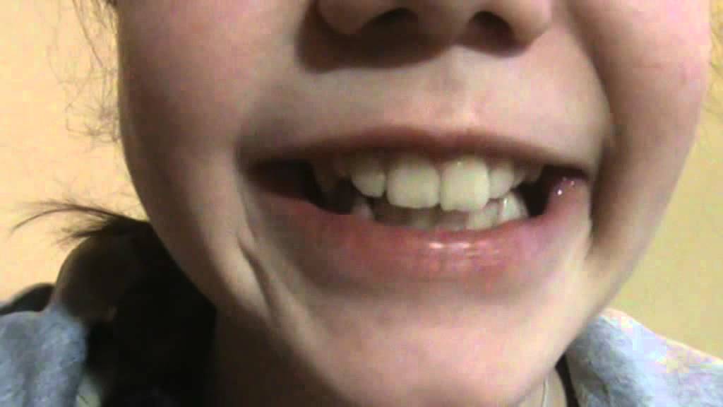 My  Video a gold five/я не кмею танцевать