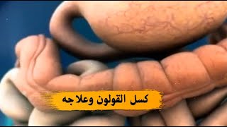 ما لا تعرفه عن  كسل القولون السبب الشائع الإمساك المزمن وكيفيةعلاجه