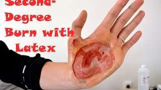 Second Degree burn SFX makeup with latex