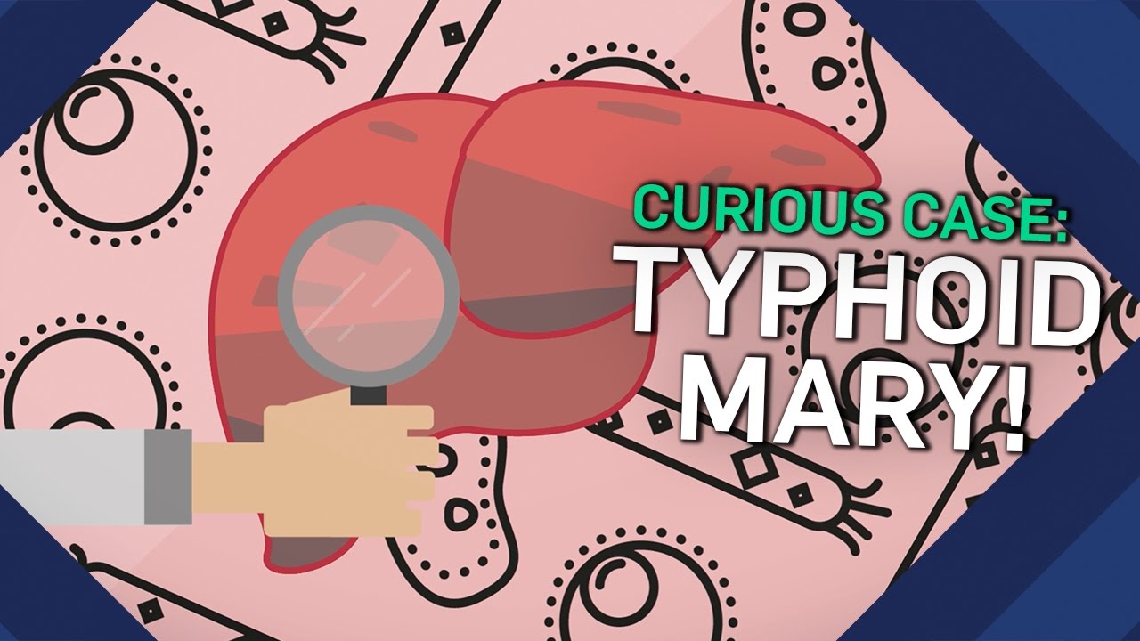 The Curious Case Of Typhoid Mary | Brit Lab